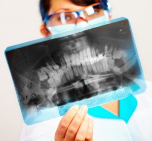 dental x-ray