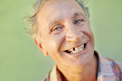 What’s wrong with losing your teeth?