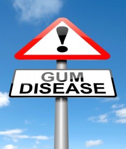 Gum Disease!