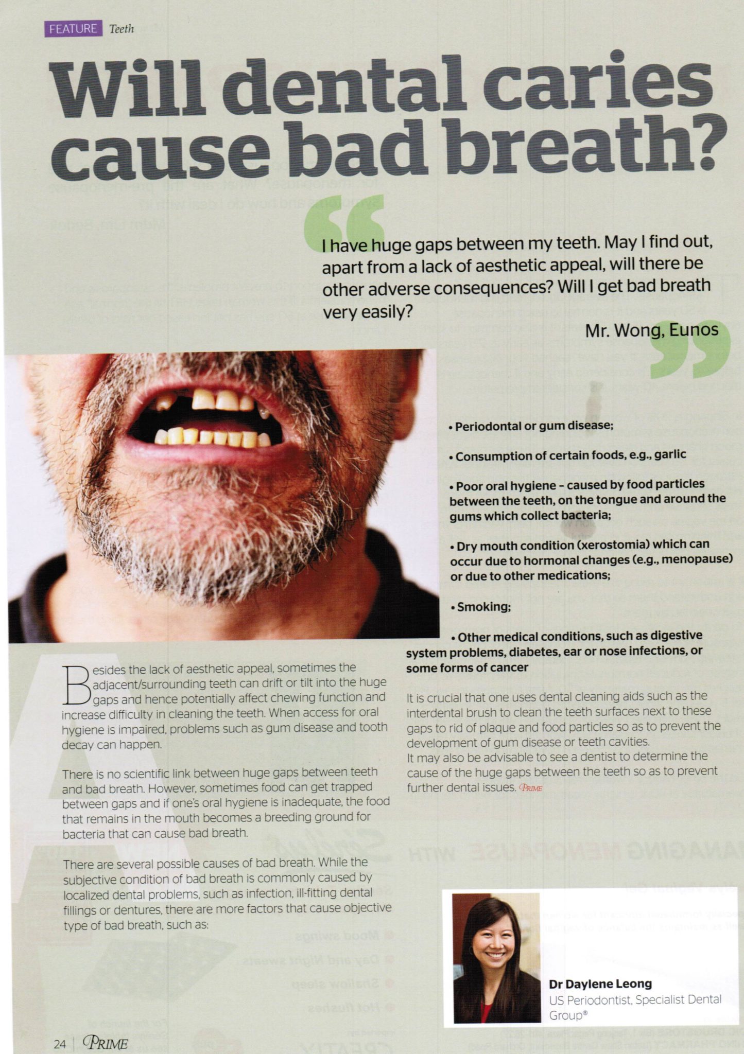 Prime Magazine, February – March 2014 issue: “Will dental caries cause bad breath?”