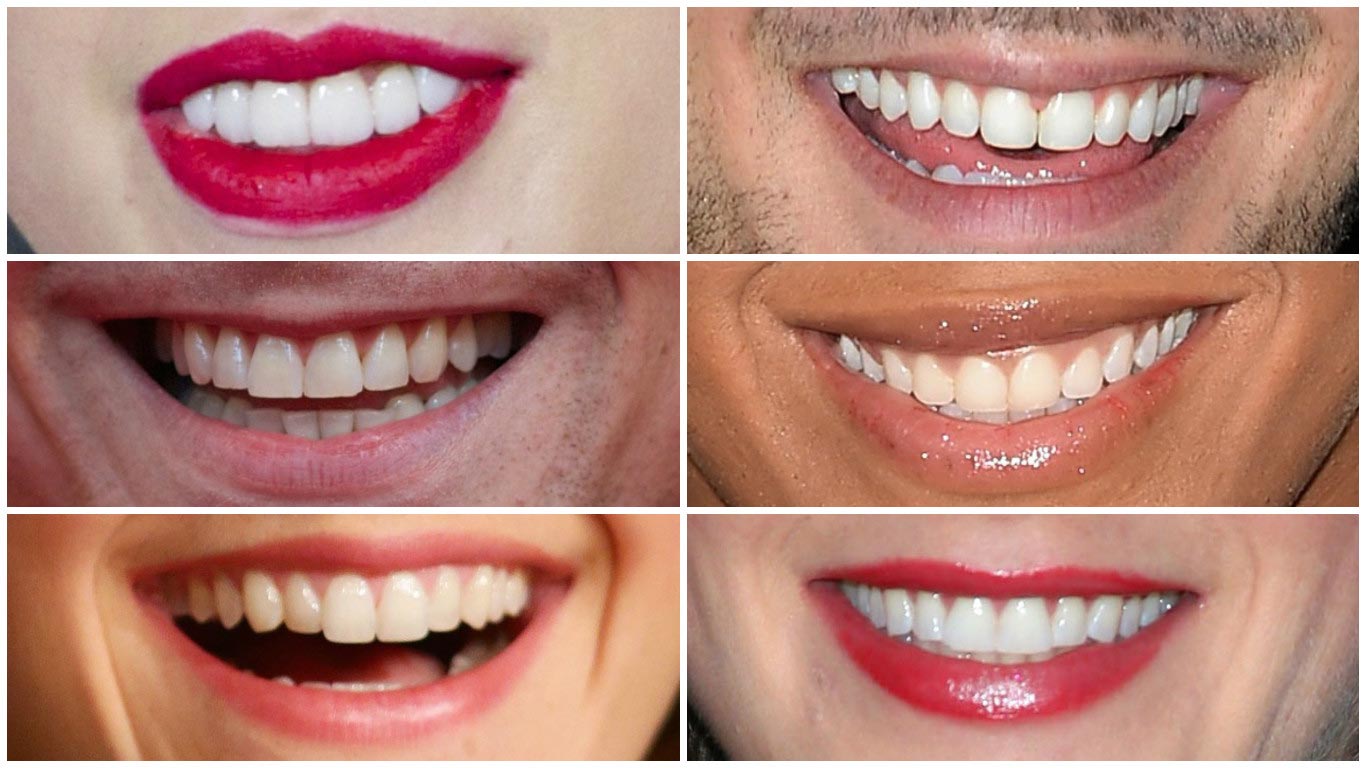 Guess whose teeth and smile are these!