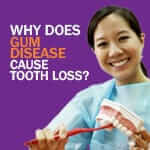Dr Daylene Leong, Dental Specialist in Periodontics, explains why gum disease cause tooth loss