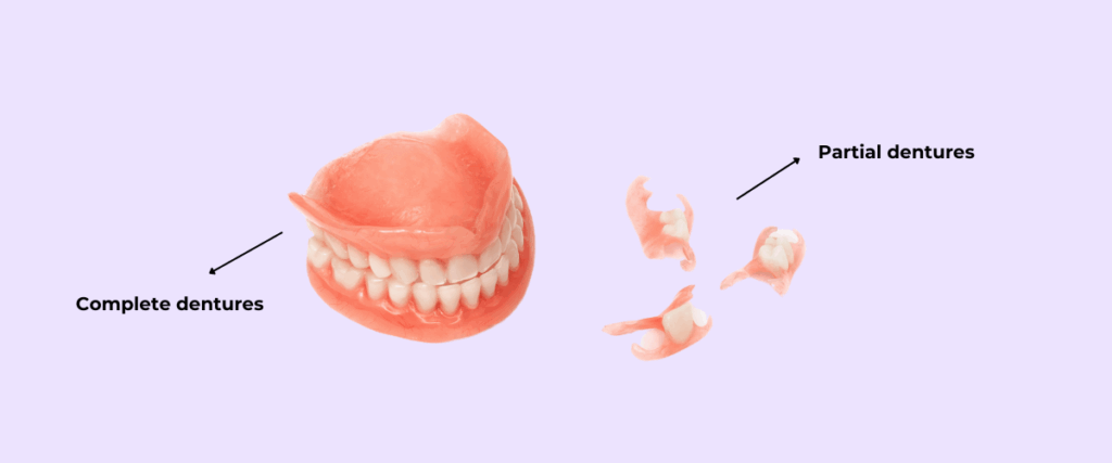 Complete dentures vs partial dentures | Missing teeth