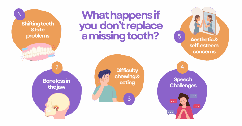 What Happens If You Don’t Replace a Missing Tooth?
