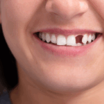 Why you shouldn't ignore missing teeth