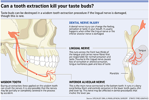 Can a tooth extraction kill your taste buds? Find out the nerves affected.