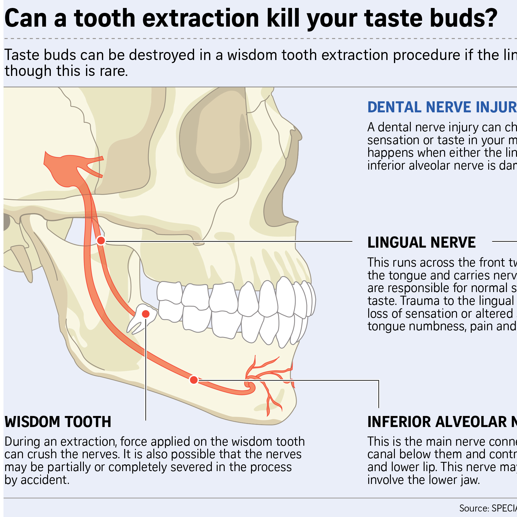 The Straits Times (9 August 2019): An oral surgeon may be needed for complicated wisdom tooth cases