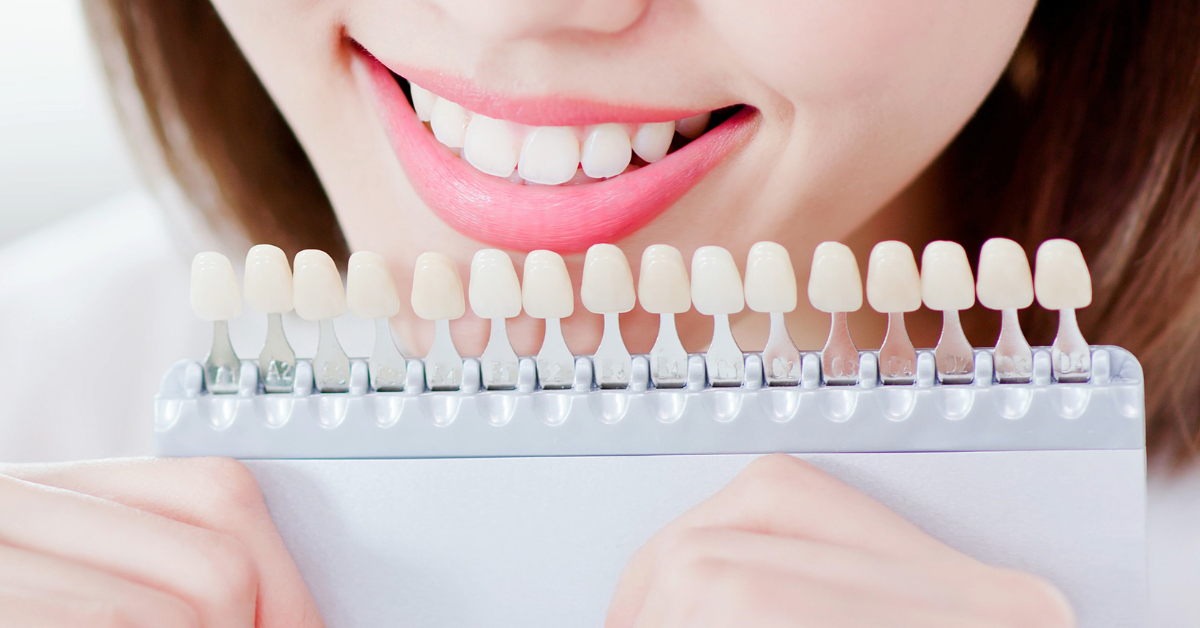 A Comprehensive Guide to Teeth Whitening Treatment