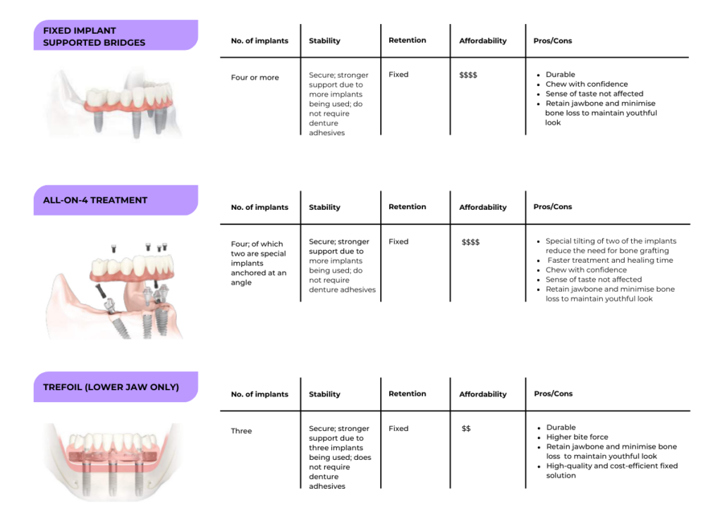 Permanent solutions for multiple missing teeth: Infographic