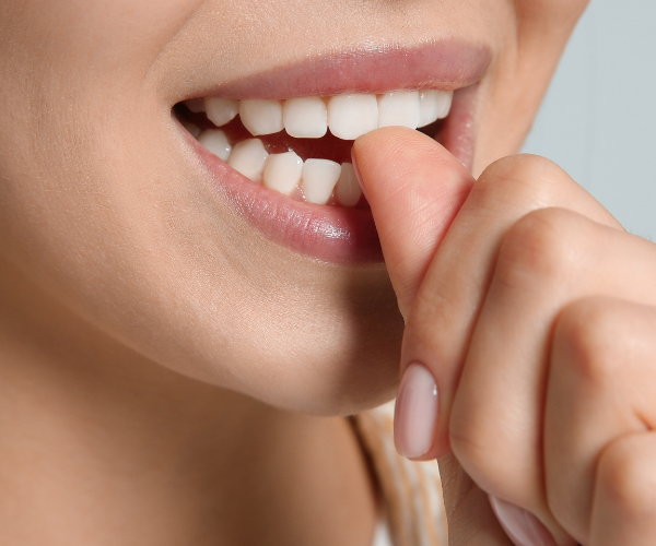 Nail biting affects your dental health