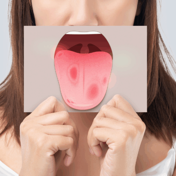 lifestyle changes to lower risk of oral cancer