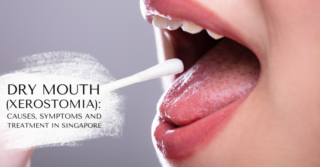 Dry Mouth (Xerostomia): Causes, Symptoms & Treatment in Singapore
