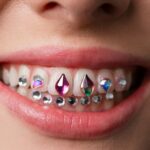 are tooth gems safe